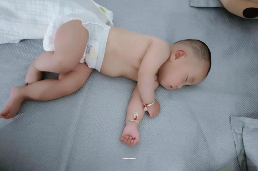 鄄城六个月宝宝眼睛散光